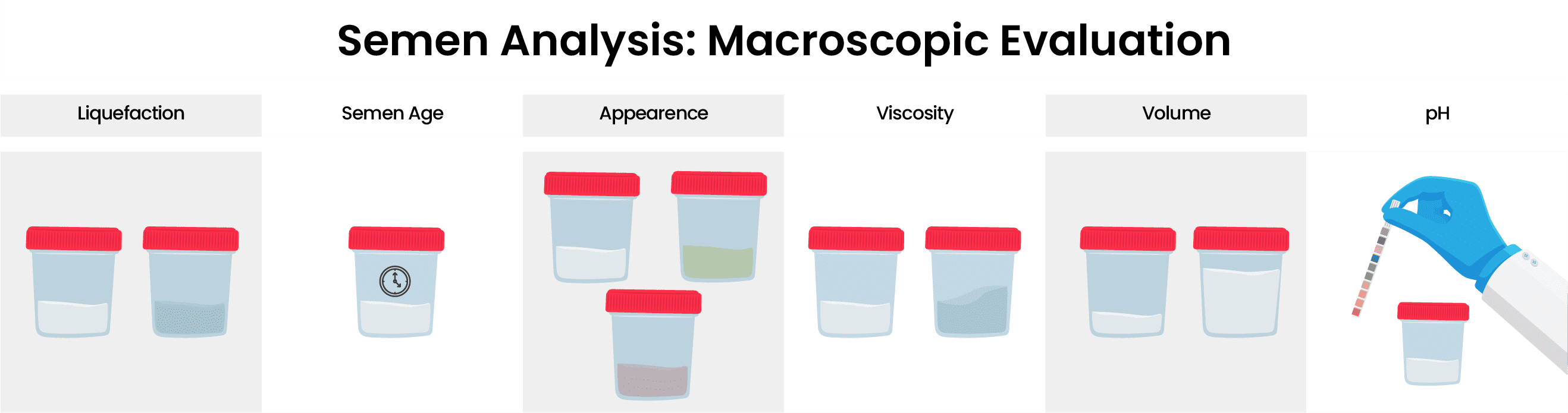 Semen-Analysis-Macroscopic-Evaluation