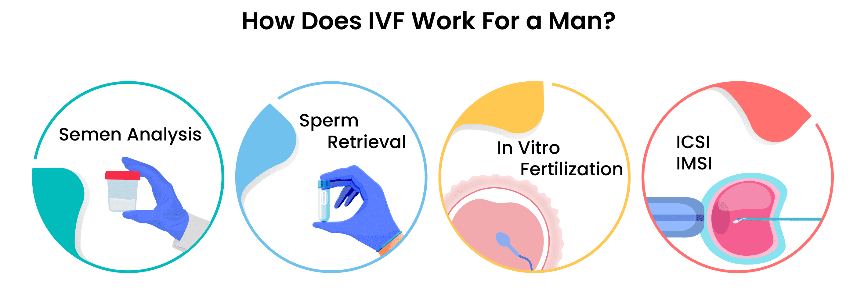 How does IVF work for a man