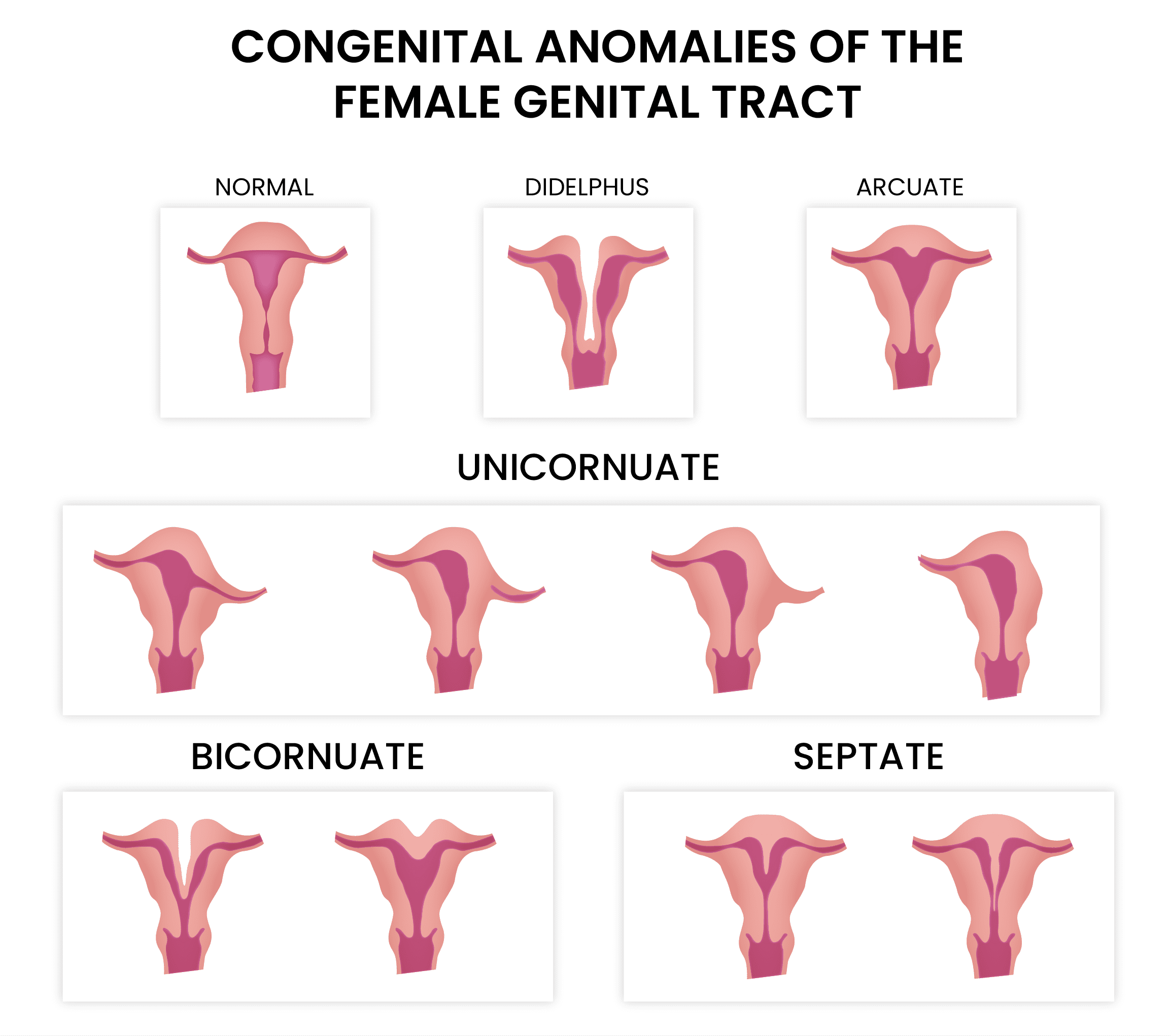 female-infertility-causes