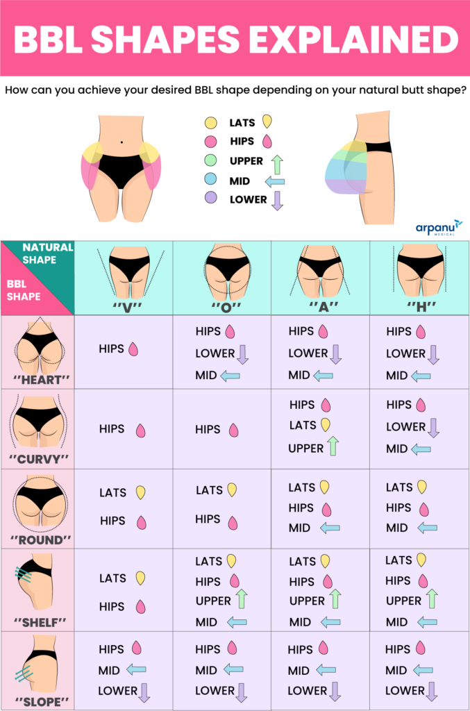 BBL shapes amp types demystified Discover your dream butt shape